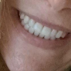 Banasiak & Nettune Orthodontic Associates - After!!