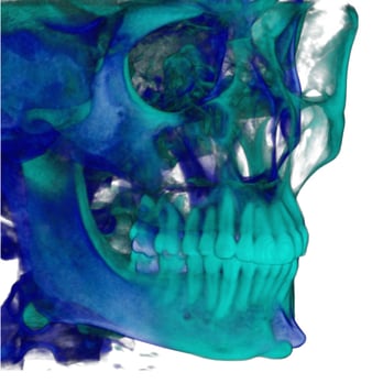 Brockton Dental X Ray Lab - 3D CBCT - General Dentistry Near Me - Riverside, California Brockton Dental X Ray Lab - 3D CBCT - General Dentistry Near Me - Riverside, California