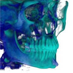Brockton Dental X Ray Lab - 3D CBCT