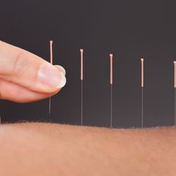 Jiao Acupuncture & Oriental Medicine