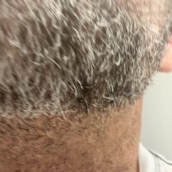 Earl Brigham Barber Shop - This was right after the shave, does it look like he used a blade?