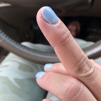 Luxor Nails and Spa - Picked cuticle too much - Nail Salons Near Me - Gladstone, Oregon Luxor Nails and Spa - Picked cuticle too much - Nail Salons Near Me - Gladstone, Oregon