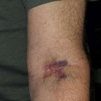 LABCORP - Updated March 2026 - 11 Photos & 16 Reviews - 954 Route 146 ...