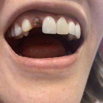 Jack Ringer, DDS - Cosmetic Dentists Near Me - Anaheim Hills, California