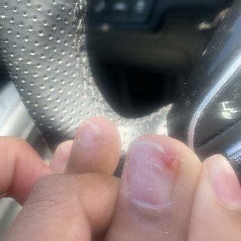 Carnes Nails - The toenail they pop the acrylic off of which caused a chunk to skin plus nail to rip - Nail Salons Near Me - Summerville, South Carolina