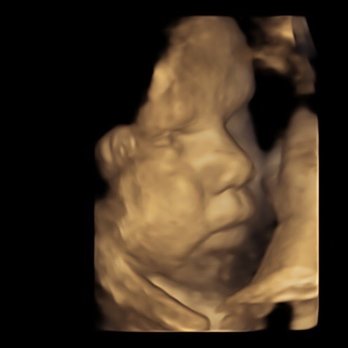 Advanced Ultrasound Services - Diagnostic Imaging Near Me - Tampa, Florida Advanced Ultrasound Services - Diagnostic Imaging Near Me - Tampa, Florida
