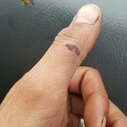 Concentra - Still swollen still sore guess if you don't have money you don't get medical attention even when your company is paying for you to be seen