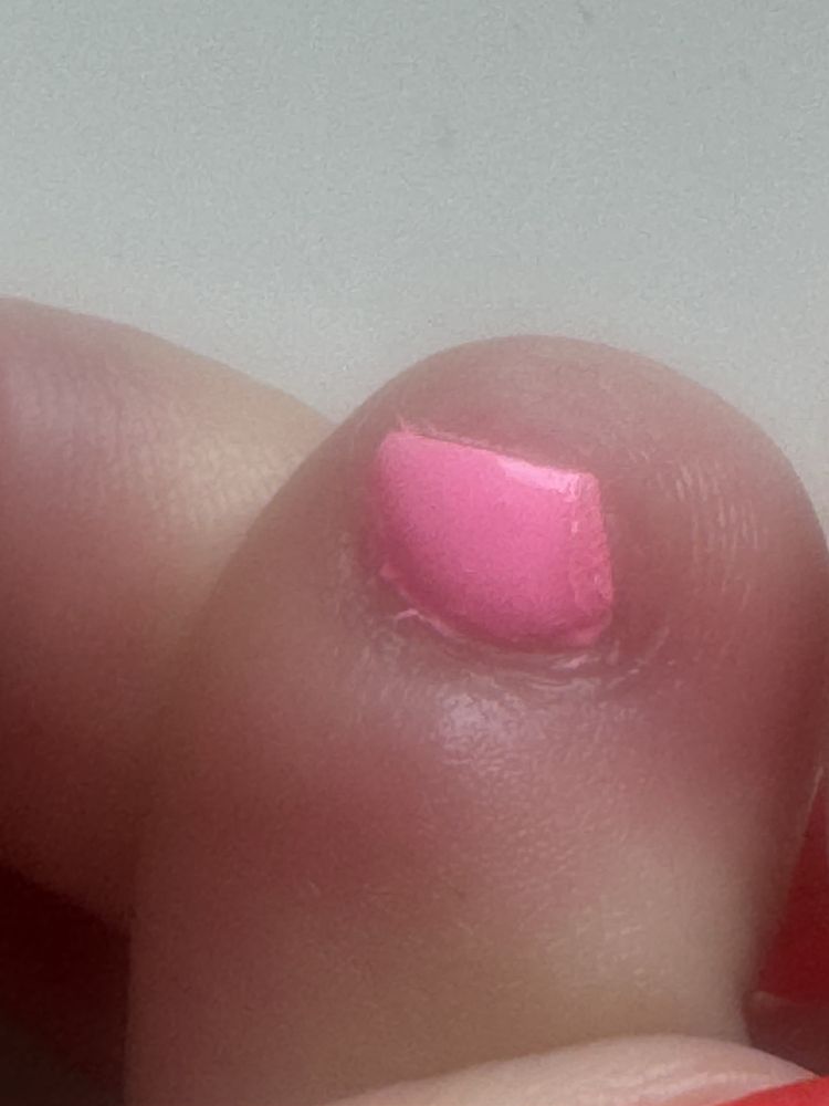 21 Nail Lounge - Baby toenail totally crooked, nail polish uneven - nail art, is duplicate - Nail Salons Near Me - Mesa, Arizona 21 Nail Lounge - Baby toenail totally crooked, nail polish uneven - nail art, is duplicate - Nail Salons Near Me - Mesa, Arizona