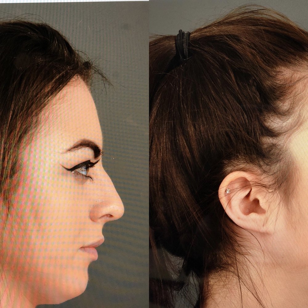 TOP 10 BEST Keloid Removal in Vacaville, CA - Updated 2026 - Yelp