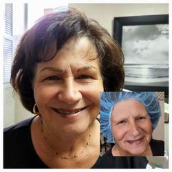 Totally Browtiful Microblading 