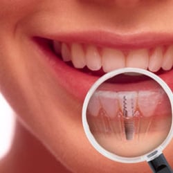 Joseph Goth, MD, DMD - Oral Surgery & Dental Implant Center