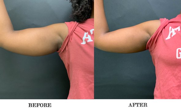 Bared Monkey Laser Spa by null