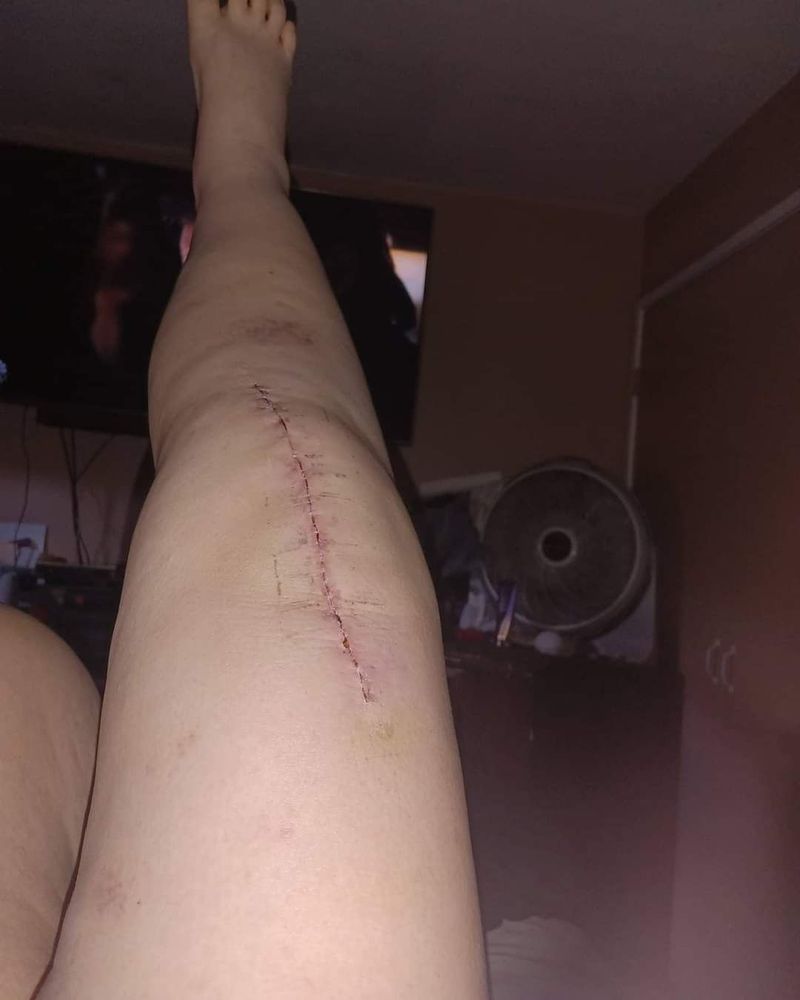JOHN L KRONICK, MD Updated September 2024 15 Reviews 2625
