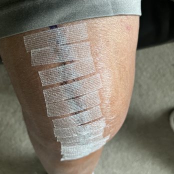 Providence - Knee replacement surgery - Hospitals Near Me - Laguna Beach, California Providence - Knee replacement surgery - Hospitals Near Me - Laguna Beach, California