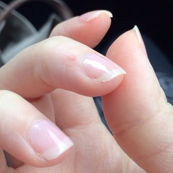 Blush Nail Spa - Jagged edges... - Nail Salons Near Me - Madison, Wisconsin