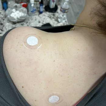 Feel The Freedom - Lifewave Icewave and Aeon patches for a shoulder issue. - Massage Therapy Near Me - Richardson, Texas Feel The Freedom - Lifewave Icewave and Aeon patches for a shoulder issue. - Massage Therapy Near Me - Richardson, Texas