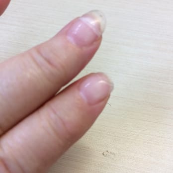 La Lotus Nails Spa - See! Bad broken nails - Nail Salons Near Me - Vancouver, British Columbia