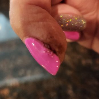 D & D Nails & Spa - Cuticles cut so deep it bled forc3 days. This is the mess they sent me home looking like. Need i say more. Picture tells the story - Nail Salons Near Me - Puyallup, Washington D & D Nails & Spa - Cuticles cut so deep it bled forc3 days. This is the mess they sent me home looking like. Need i say more. Picture tells the story - Nail Salons Near Me - Puyallup, Washington
