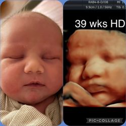 Baby Dimensions - Extraordinary imaging at this late stage of pregnancy, can't wait to hear from you ladies in the future to see the greatest show on Earth.