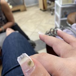 Melody Nails - After Gel X nail development fungus