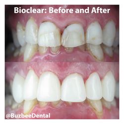 Buzbee Dental