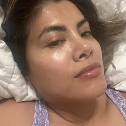 After Facial care n Needling from Li spa... My skin have a new level. No make up or filter at all. Permanent tattoo lip fyi. After Facial care n Needling from Li spa... My skin have a new level. No make up or filter at all. Permanent tattoo lip fyi.