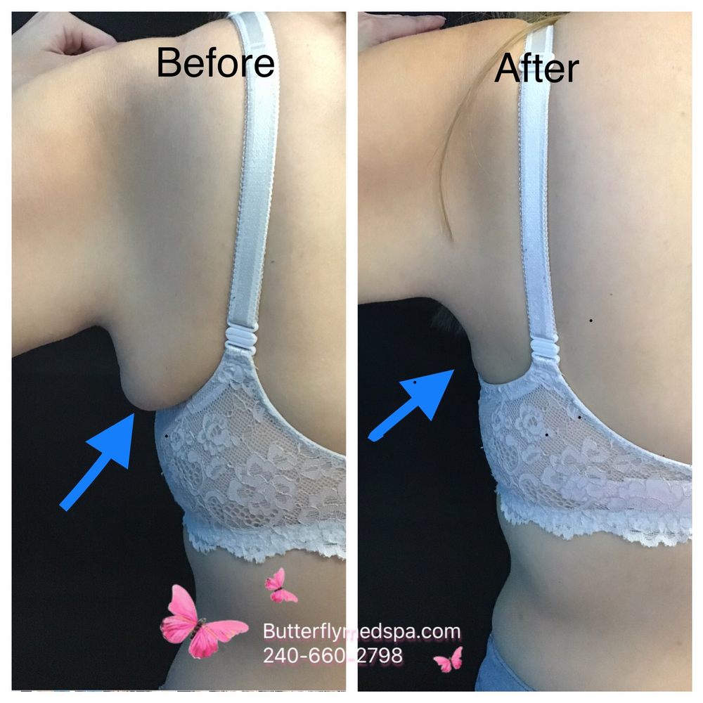 Butterfly Medical Spa