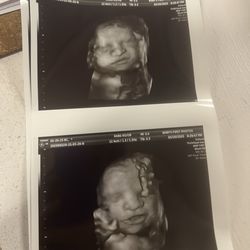 My baby boy
