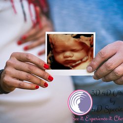 3D 4D Ultrasound by 4D Special Delivery - HD Live Ultrasound