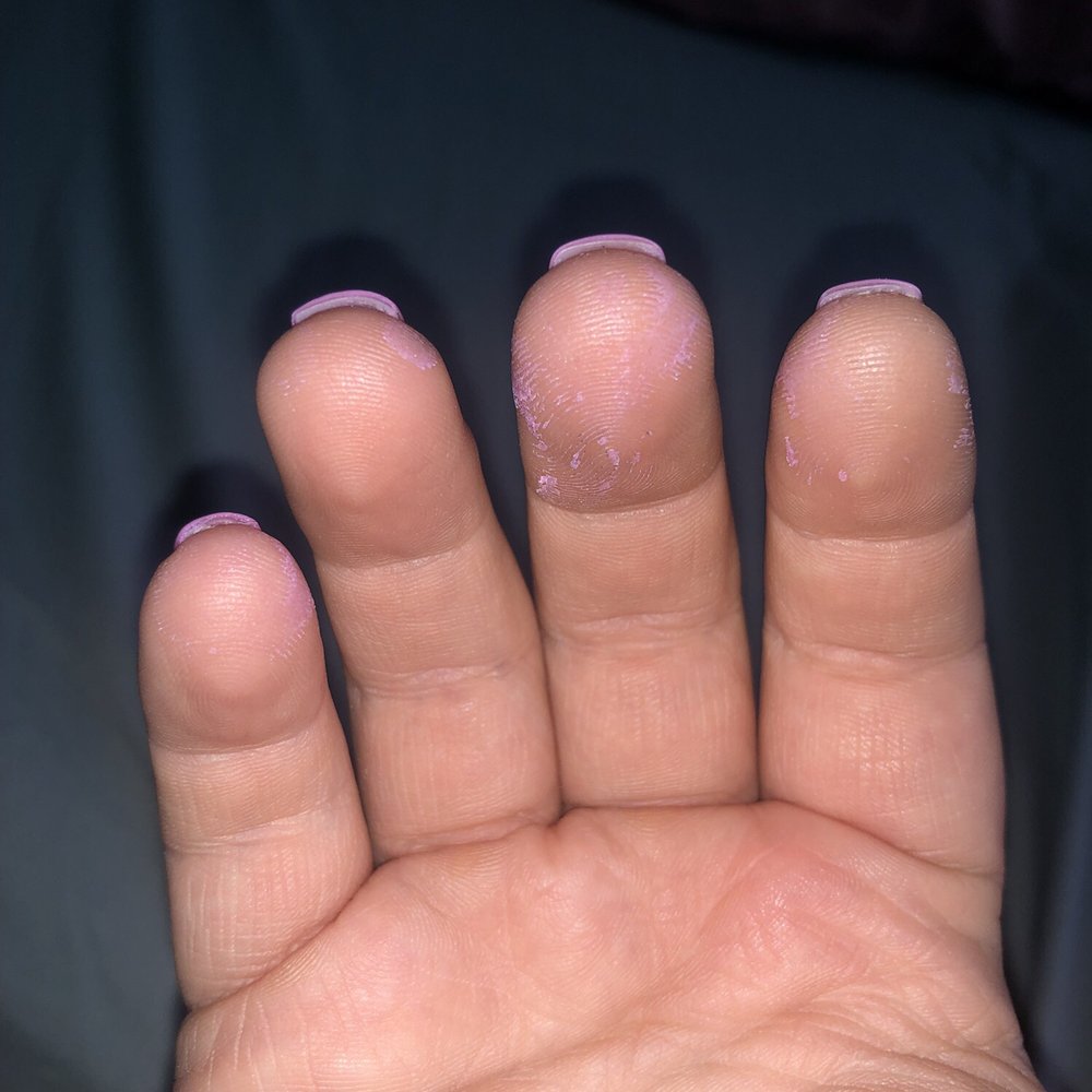 Lee Nails & Salon - SNS stains on my hands - Nail Salons Near Me - Windermere, Florida Lee Nails & Salon - SNS stains on my hands - Nail Salons Near Me - Windermere, Florida