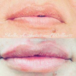 Shelbi Aesthetics and Wellness