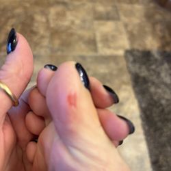 Hollywood Nails - Skin burnt off from using the skin grater on side of my toe