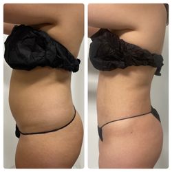 Premiere Body Sculpting