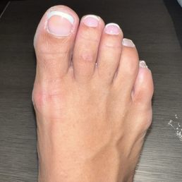 New Image Nails - Now missing one on the other foot - Nail Salons Near Me - Middletown, Delaware
