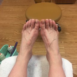 Feet getting callouses removed Feet getting callouses removed