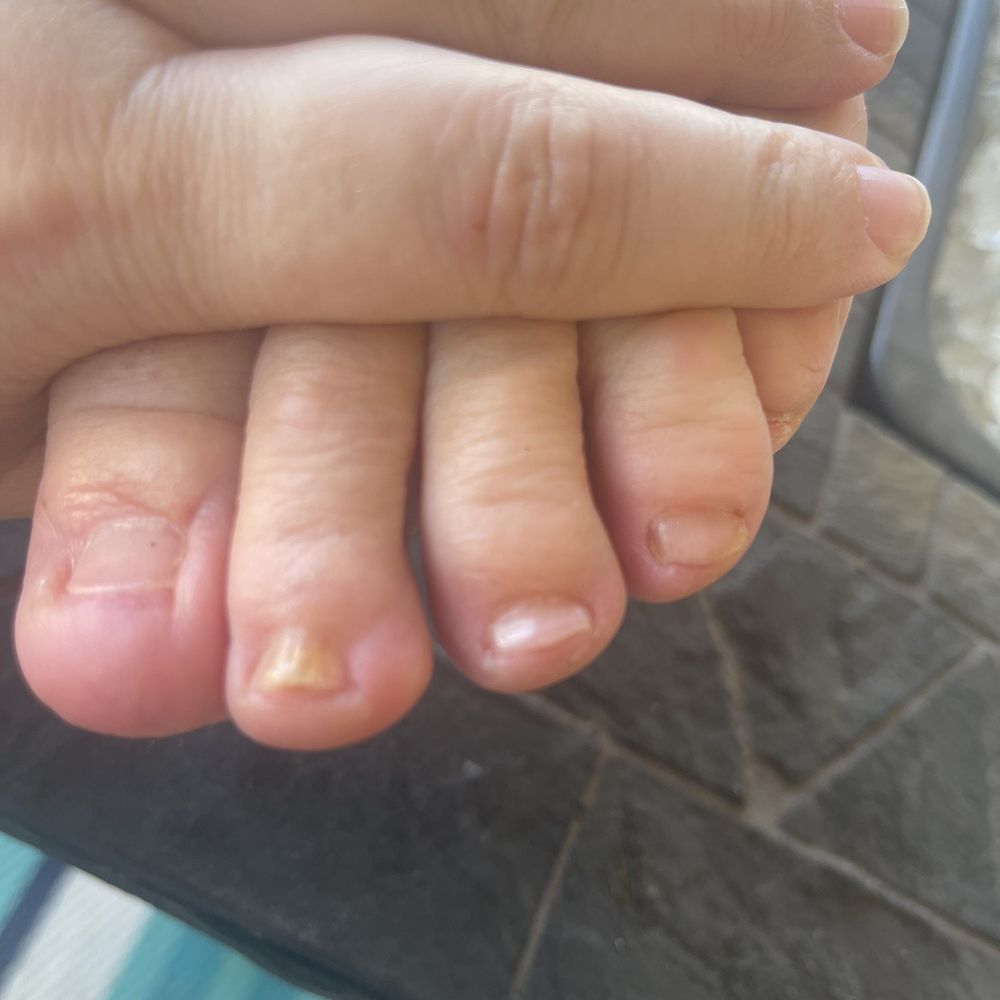 Creative Nails & Spa - Terrible pedicure - Nail Salons Near Me - Scottsdale, Arizona
