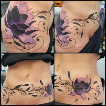 Doc's Tattooz - Lotus Flower (tummy tuck scar cover up) by Allen Mertsock - Tattoo Near Me - Marathon, Florida