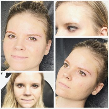 Premier Medspa - Before and After - Medical Spas Near Me - Dayton, Ohio Premier Medspa - Before and After - Medical Spas Near Me - Dayton, Ohio