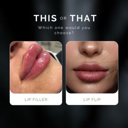 Medspa Nirvana by Noel - Lip Filler vs Lip Flip