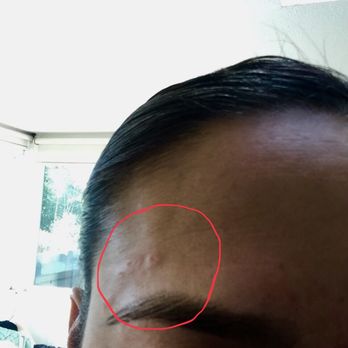 Mary's Threading - So sad to share this experience. I have purchased multiple packs, and this is the first time with multiple wounds on both brows and lip. - Threading Services Near Me - San Diego, California Mary's Threading - So sad to share this experience. I have purchased multiple packs, and this is the first time with multiple wounds on both brows and lip. - Threading Services Near Me - San Diego, California