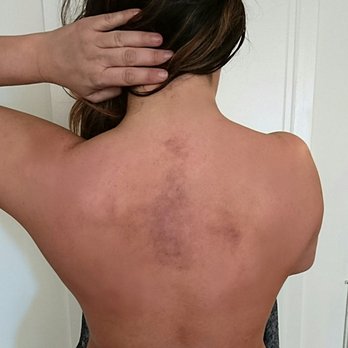Asian Massage - The result of my received torture at this place the next morning!!! 12/4/2016 Stay Away from this place!!! - Massage Near Me - Beverly Hills, California Asian Massage - The result of my received torture at this place the next morning!!! 12/4/2016 Stay Away from this place!!! - Massage Near Me - Beverly Hills, California