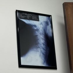 Yonsei Chiropractic Clinic - The normal physiological curvature.