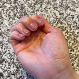 Chipped nail