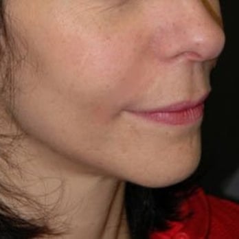 J Spa Medical Day Spa - Medical Spas Near Me - Great Neck, New York J Spa Medical Day Spa - Medical Spas Near Me - Great Neck, New York
