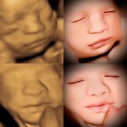 BUMP TO BIRTH ULTRASOUND - Updated November 2025 - 18 Photos