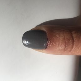 Cut cuticle to short bleed for 5 minutes they sealed it with superglue. Cut cuticle to short bleed for 5 minutes they sealed it with superglue.