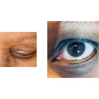 Emerge Beauty - Before and after upper and lower eye liners. - Day Spas Near Me - Las Vegas, Nevada Emerge Beauty - Before and after upper and lower eye liners. - Day Spas Near Me - Las Vegas, Nevada