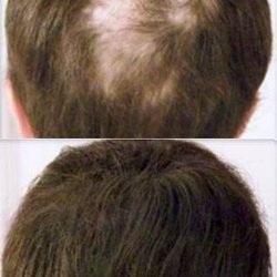 Crown Clinic - cosmetic concealers & thickeners