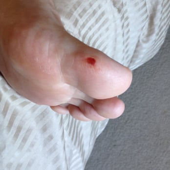 Lavender Nail Spa - This is what Judy did to my Husband's foot on 10/12/13. He left there with a spot on his big toe, scrapped raw/bloody!!! - Nail Salons Near Me - Vacaville, California Lavender Nail Spa - This is what Judy did to my Husband's foot on 10/12/13. He left there with a spot on his big toe, scrapped raw/bloody!!! - Nail Salons Near Me - Vacaville, California