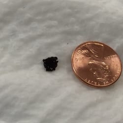 Ridgefield Family Medicine - Mold that came out of the facet in room three